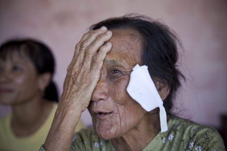 Philanthropy Can Stop Preventable Blindness That's Costing Billions