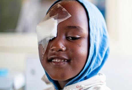 A young, smiling Fred Hollows patient in a blue hood with a bandage over one eye